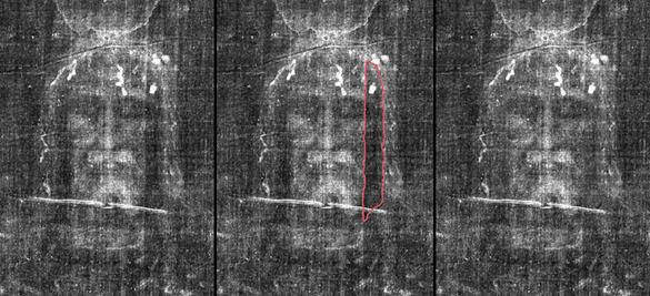 Photograph 5 - Face compared both sides